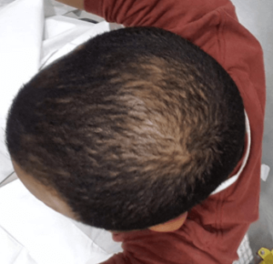 שמפו Ultrax Labs Hair Surge