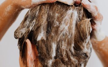 האם שמפו הד אנד שולדרס יכול לגרום לנשירת שיער?
